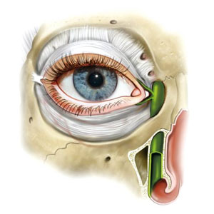 congenital lacrimal duct block management